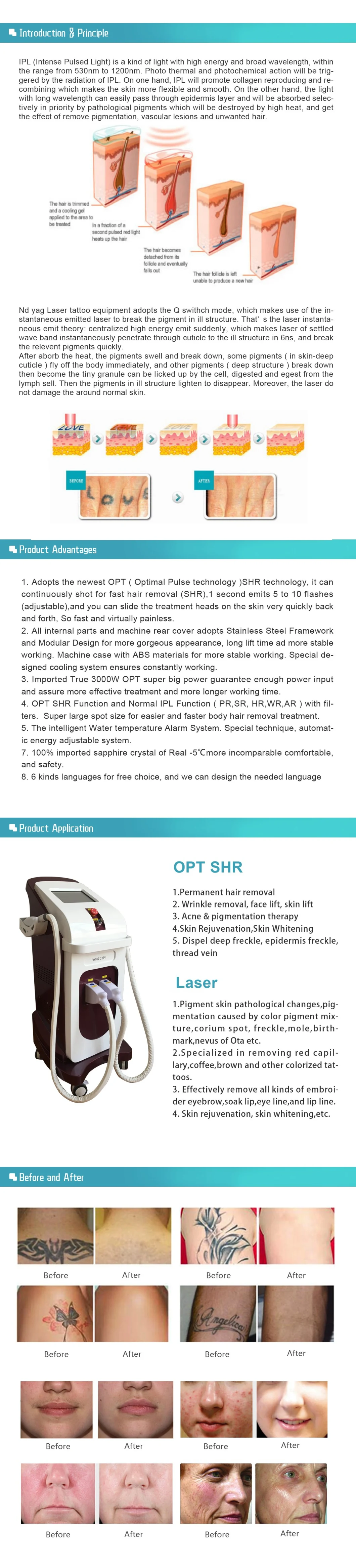 Ce Approved Multifuncional ND YAG Laser & Opt IPL 2 in 1 Machine