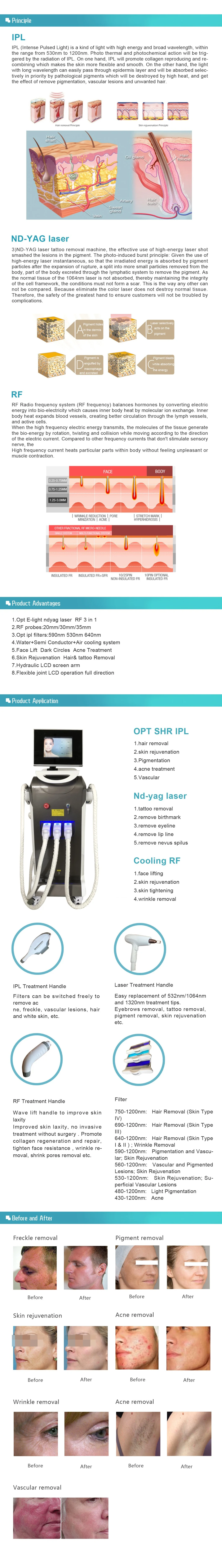 Opt IPL+RF+ND YAG Laser Multifunctional Hair Removal Machine
