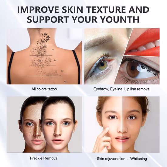 Professional Picosecond Laser Pigmentation Removal Pico Laser Picolaser Q-Switched ND YAG Laser Tattoo Removal with CE Approval