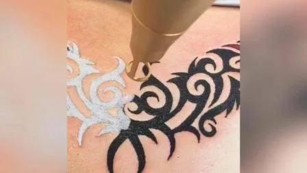 Laser picoseconde de retrait de tatouage de machine de beauté de salon